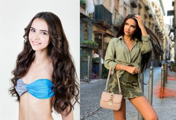 Яна Орфєєва до та після пластики