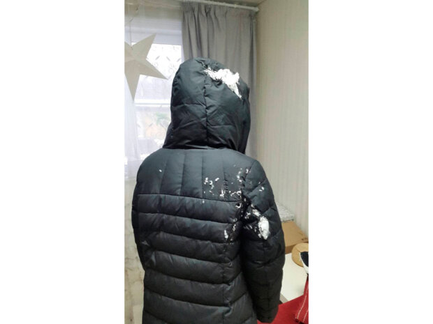 Школяр в Росії облив однокласницю антисептиком і підпалив