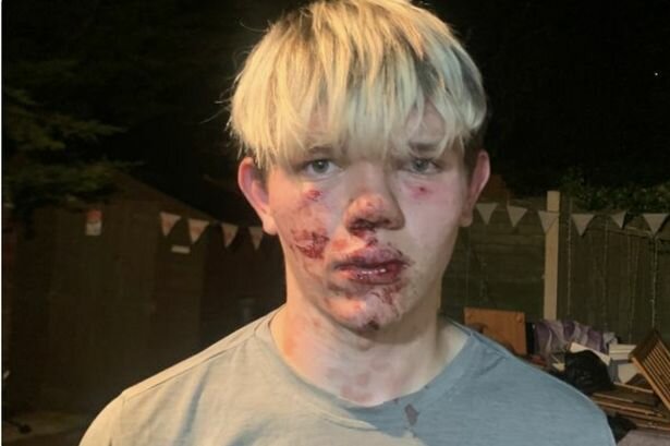 хлопчика з аутизмом побили заради розваги