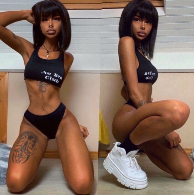 Дівчина уколами перетворила себе на іншу людину