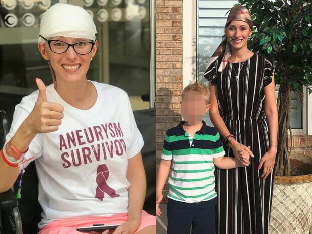 королеві краси видалили частину черепа