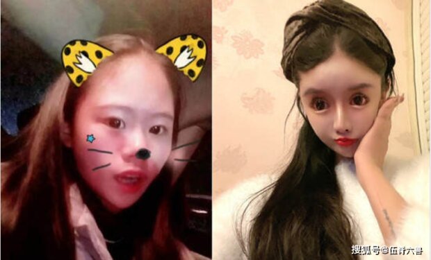 Школьница сделала более 300 пластических операций