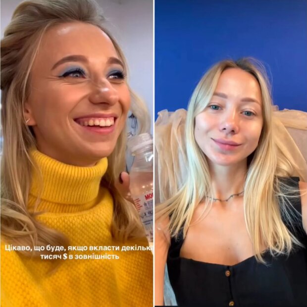 Дружина Віктора Павліка Катя Репяхова до та після операцій