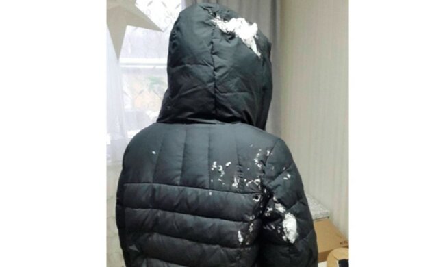 Школяр в Росії облив однокласницю антисептиком і підпалив