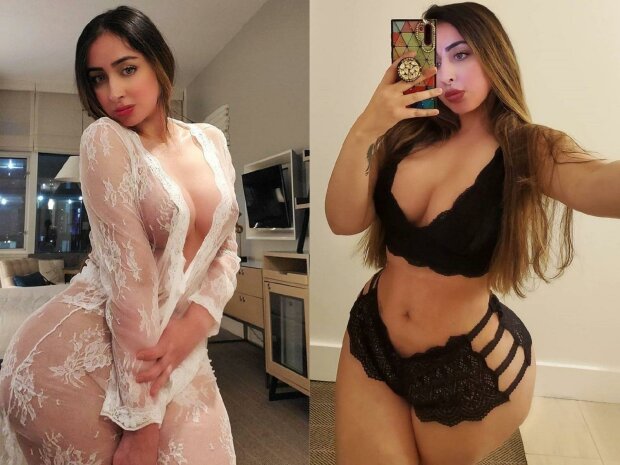 Модель зробила операцію мрії і більше не змогла сидіти