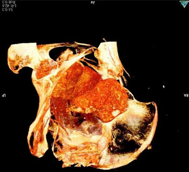 перша в світі давньоєгипетська вагітна мумія