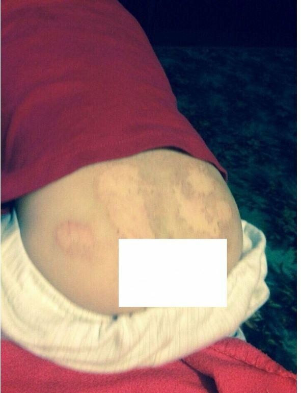 Постраждала дитина