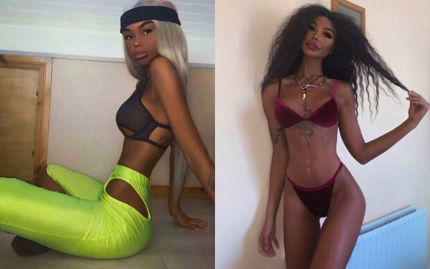 Дівчина уколами перетворила себе на іншу людину