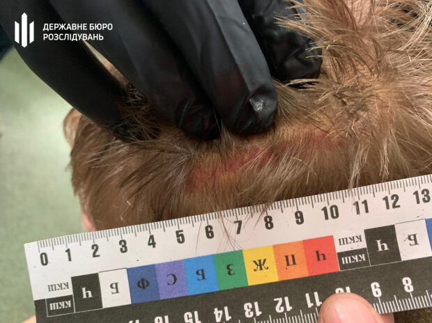 Поліцейські "працювали" с затриманим пожежним шлангом та залізним стільцем