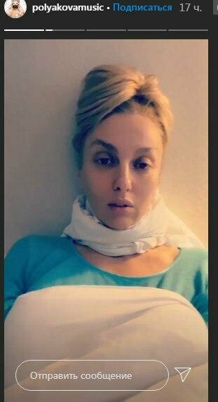 Оля Полякова в Сторі