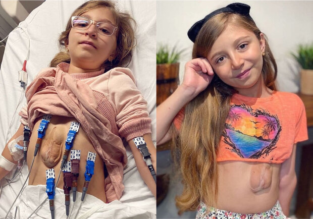 Дівчинка народилася з серцем зовні