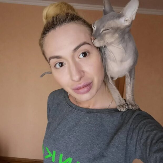 Анасасия Покрищук до пластики