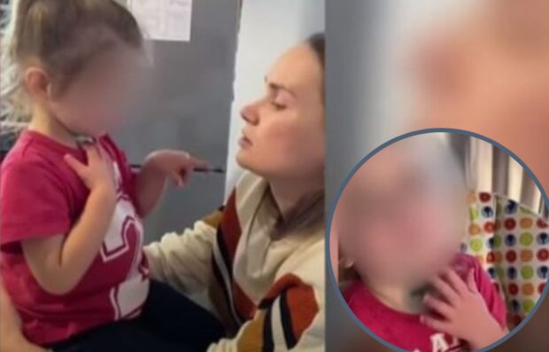 Постраждала дитина з мамою, кадри з відео