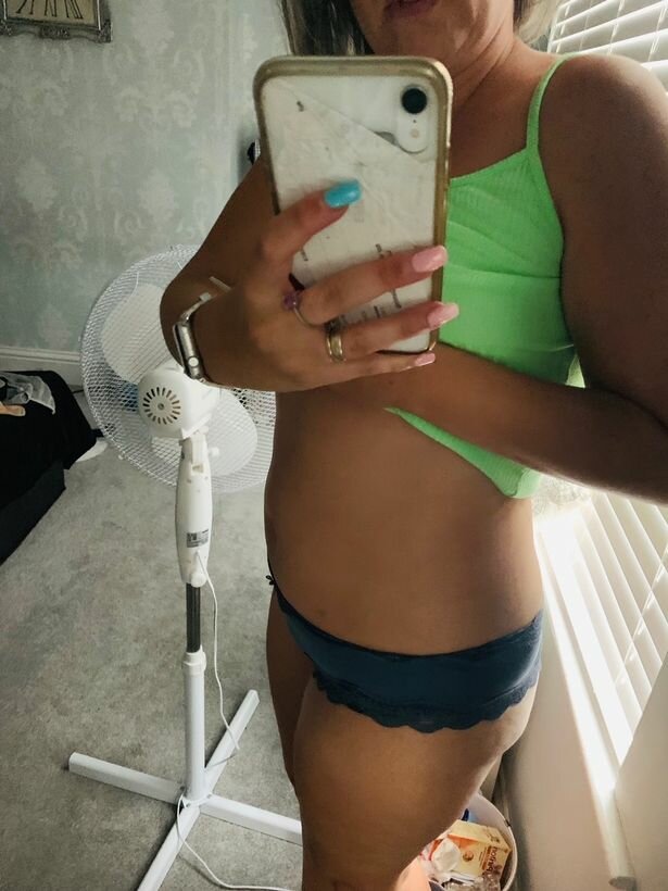 Жінка позбулася яєчників через помилку лікарів