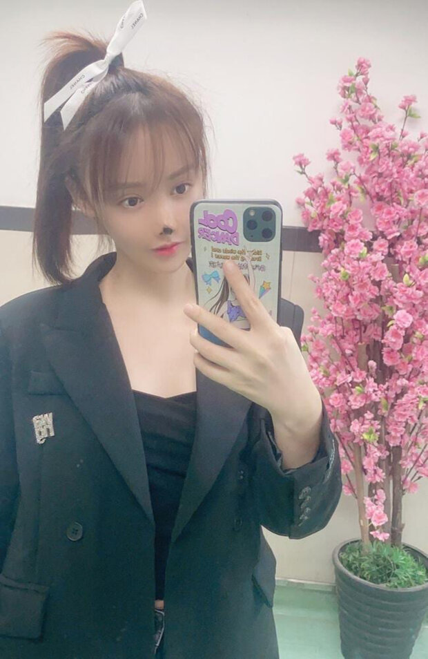 Після легкої пластики обличчя у юної актриси почав відмирати ніс