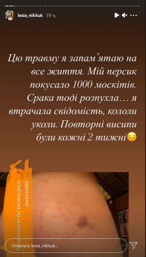 Stories Леси Никитюк