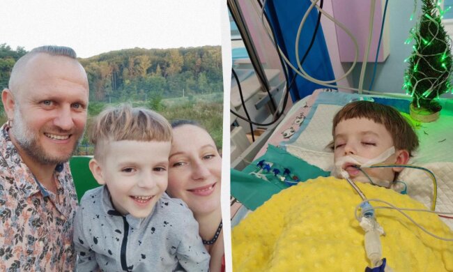 Хлопчик впав у кому після видалення молочних зубів