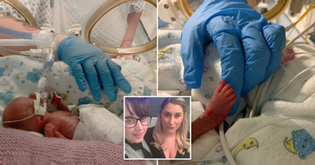 Лікарі врятували недоношеного новонародженого запхавши його в кульок для бутербродів