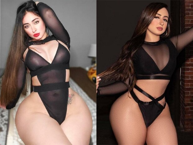 Модель зробила операцію мрії і більше не змогла сидіти