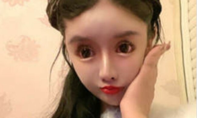 Школярка зробила понад 300 пластичних операцій