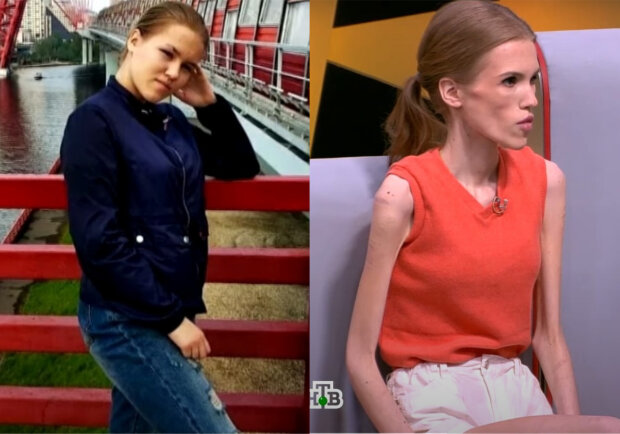 тренер довел подопечную до анорексии