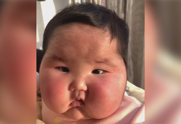 лицо ребенка превратилось в шар после увлажняющего крема