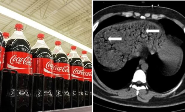 Чоловік залпом випив півтора літра Coca Cola і помер
