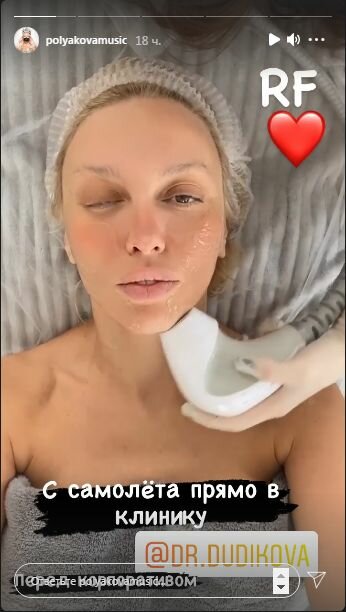 Сториз Оли Поляковой