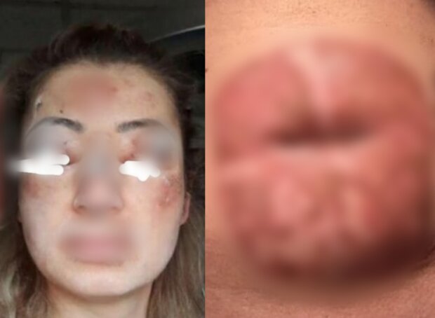 Сербська лікарка спотворювала своїх пацієнток