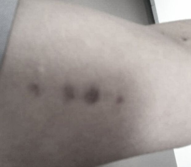 Синці Поли Сміт