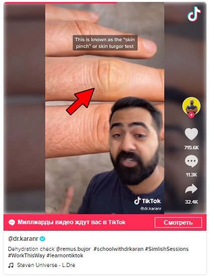 Пост ТикТок