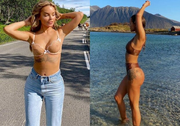 Відомій співачці хірург вставив у груди сідничні імплантанти