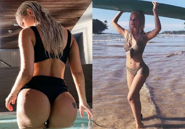 Відомій співачці хірург вставив у груди сідничні імплантанти