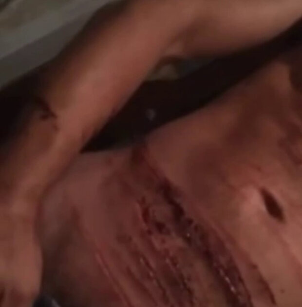 порізаний психопат