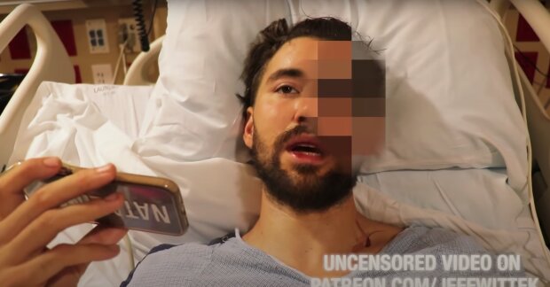 блогер розкроїв собі череп