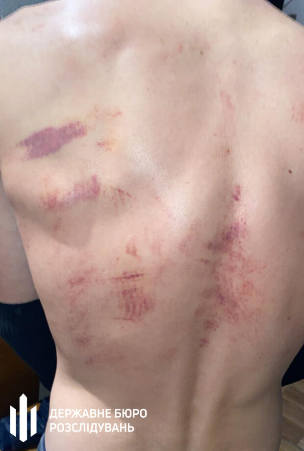 Поліцейські "працювали" с затриманим пожежним шлангом та залізним стільцем