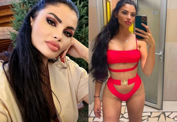 Сербська лікарка спотворювала своїх пацієнток