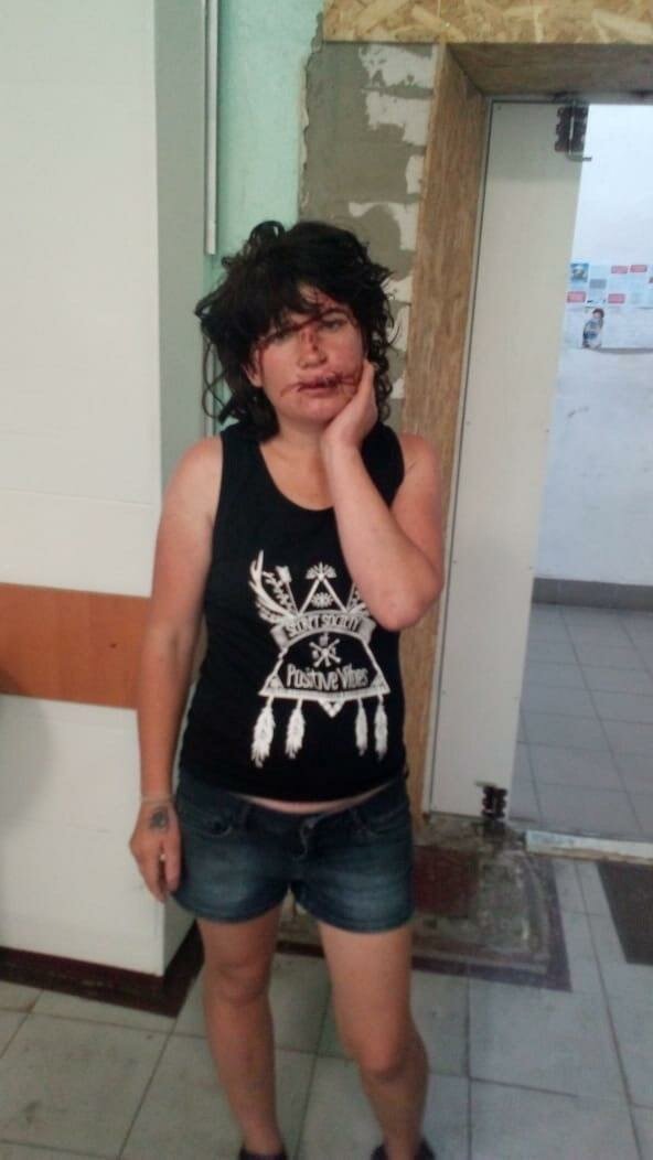 У Дніпрі чоловік побив жінку ногами в обличчя