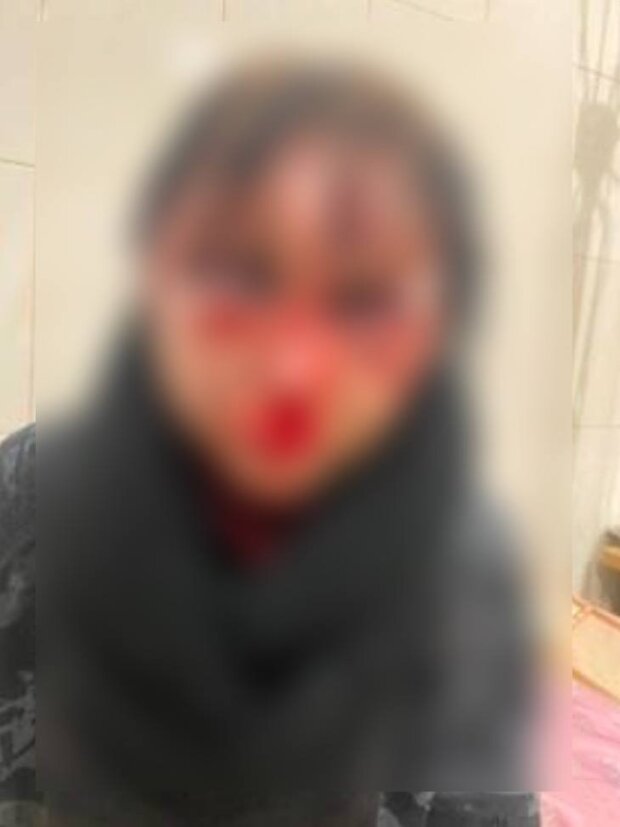 Пострадавшая, фото: Нацполиция