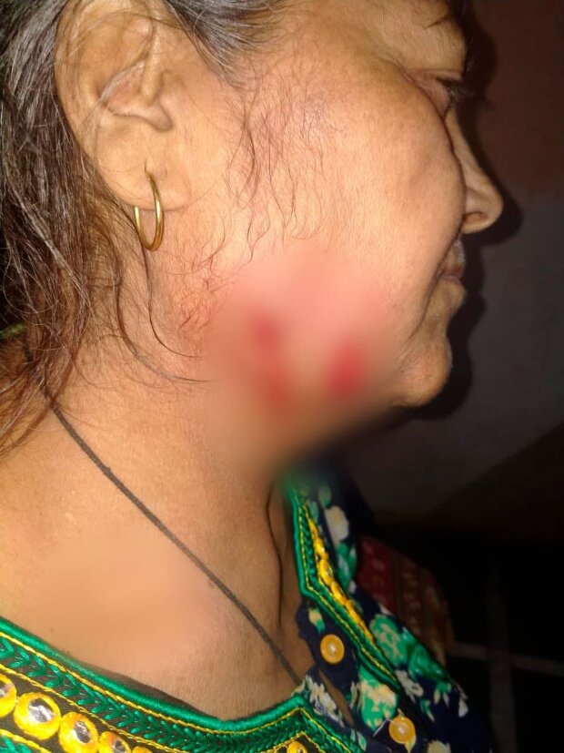 жінка відбилася від леопарда тростиною