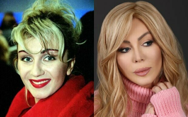 Ірина Білик до/після