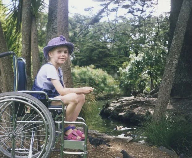 Модель пережила рак і ампутацію