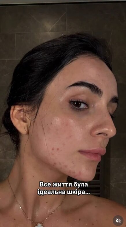 Анна Тринчер без макияжа