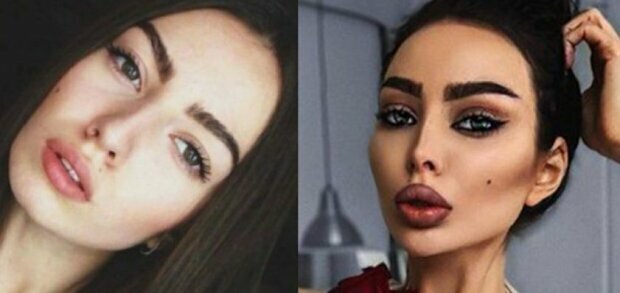 Олена Омович до/після