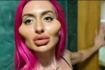 Накачала губы и увеличила скулы: звезда считает, что стала красавицей