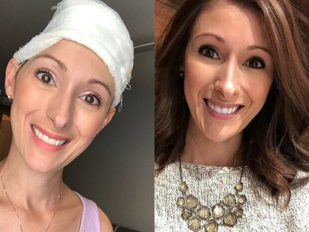 королеві краси видалили частину черепа