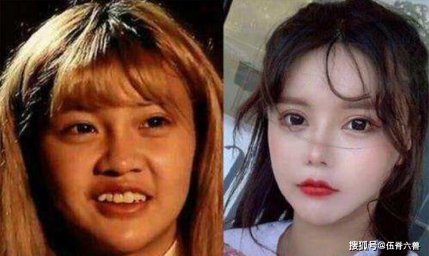 Школьница сделала более 300 пластических операций