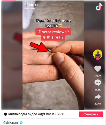 Пост ТикТок