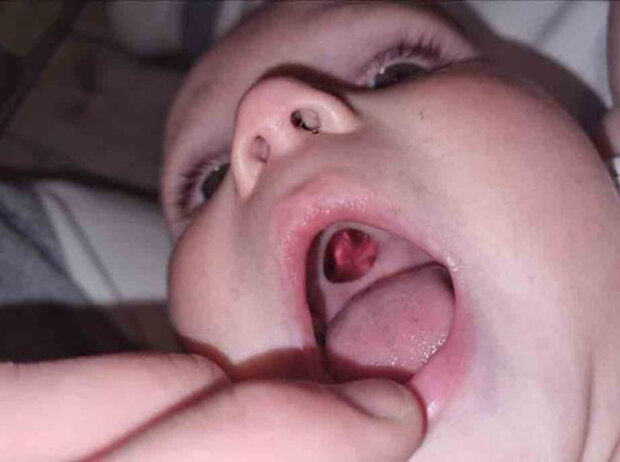 испуганная мать нашла дырку в небе ребенка