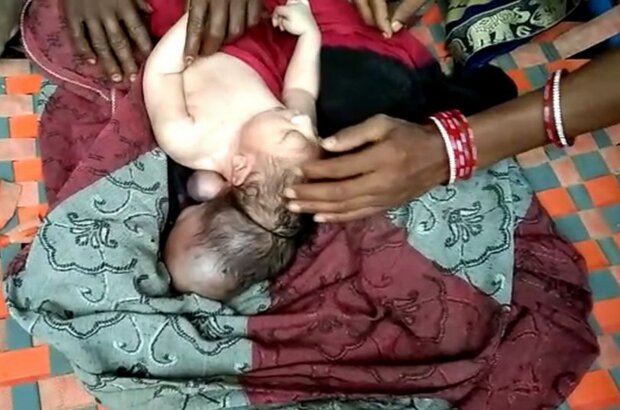 Трехголовый ребенок